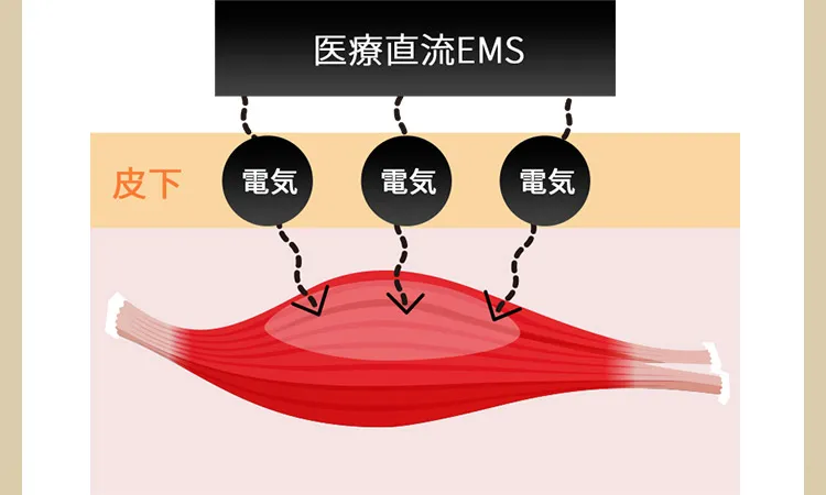 医療直流EMS