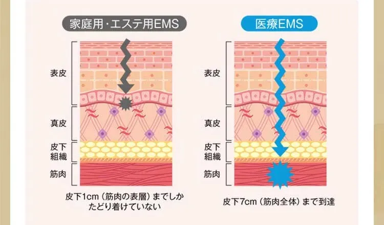 家庭用・エステ用EMS　皮下1cm（筋肉の表層）までしかたどり着けていない　医療EMS　皮下7cm（筋肉全体）まで到達