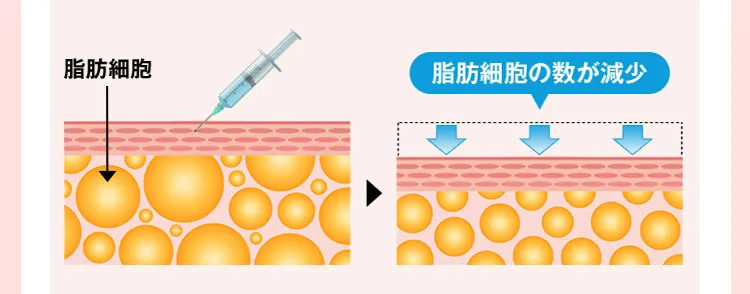 脂肪細胞　脂肪細胞の数が減少