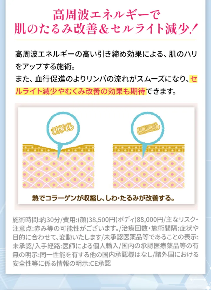 医療ラジオ波＜顔・ボディ＞