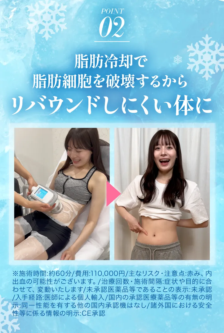 ポイント02