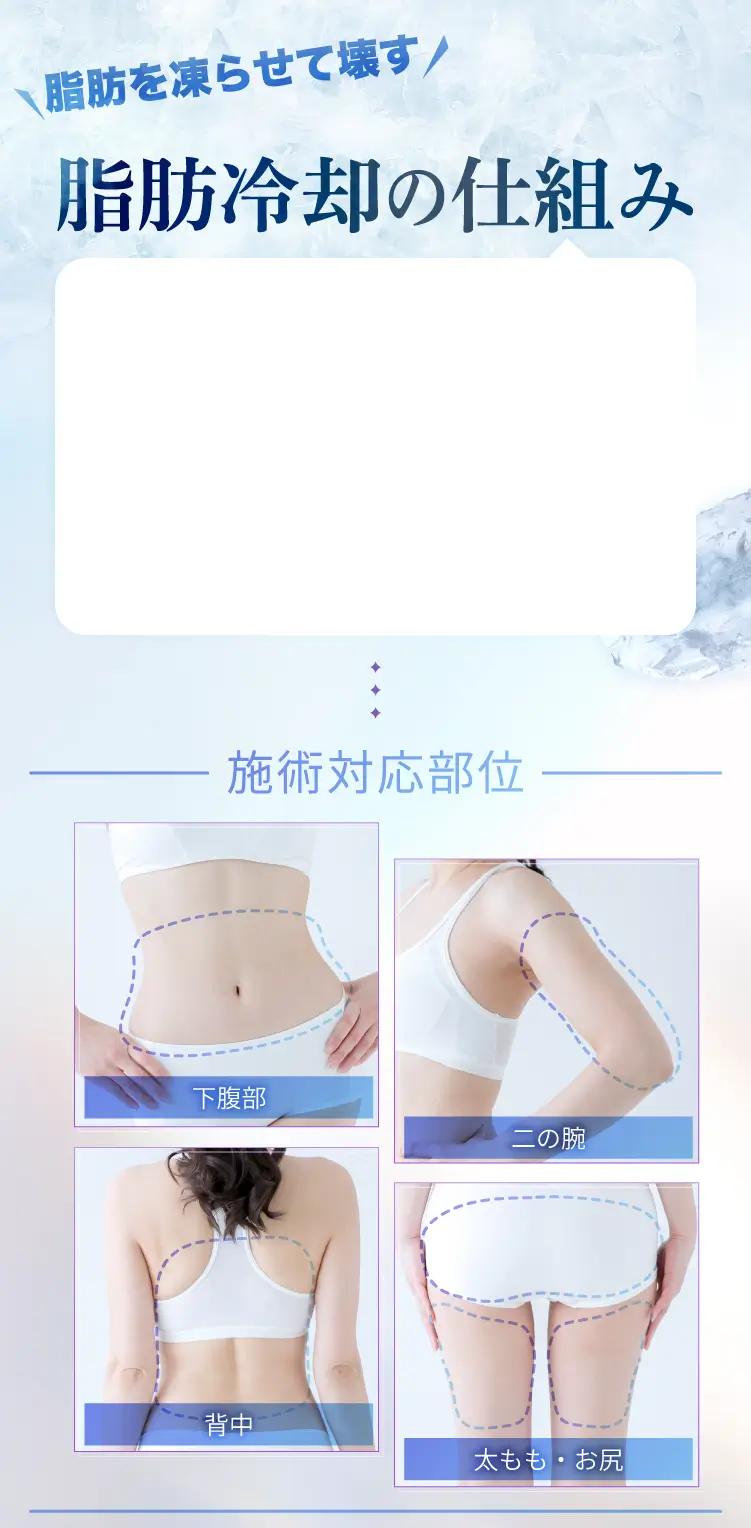 脂肪冷却の仕組み